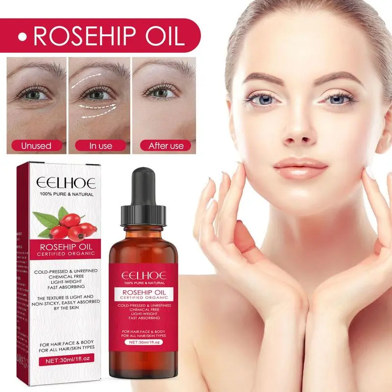 Óleo de semente de rosa mosque - Cold Pressed Rose Hip avaliação e preço