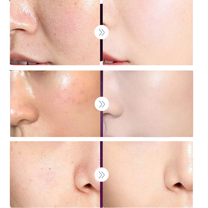Luxo nobre senhora pérola bran - Luxury Skincare Women avaliação e preço